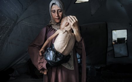 Despite Efforts to Shift the Blame, Israeli Policies Are Starving Children