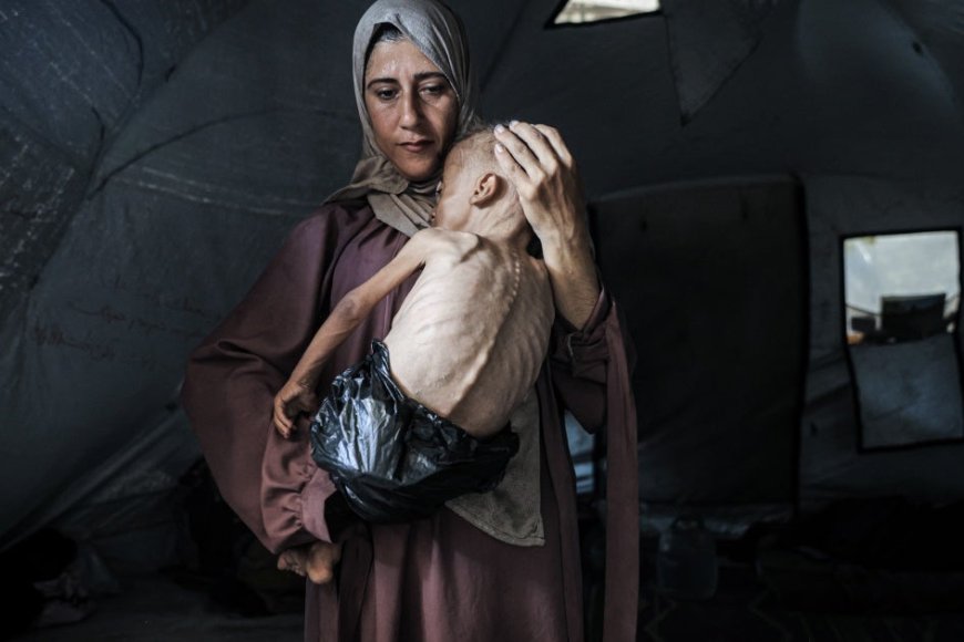 Despite Efforts to Shift the Blame, Israeli Policies Are Starving Children